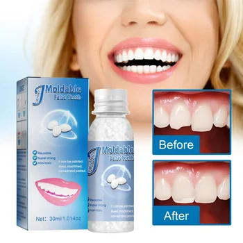 Комплект за ремонт на формуемых зъби, комплект за временна замяна на зъбите, термошарики за пломбирования, подмладяващи липсващи и счупени изкуствен Зъб